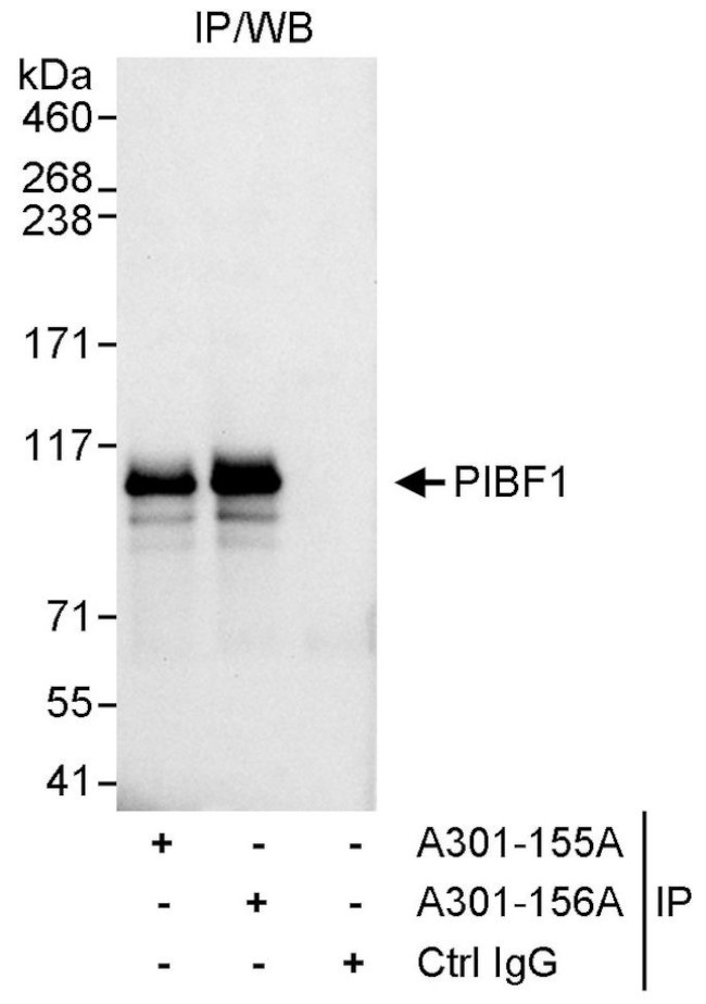 PIBF Antibody in Immunoprecipitation (IP)