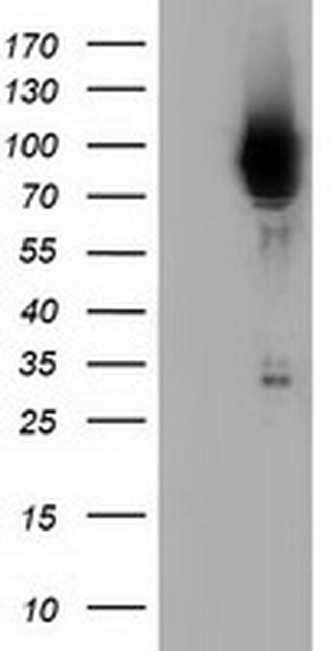 PIK3AP1 Antibody in Western Blot (WB)