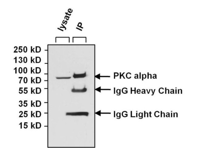PKC alpha Antibody in Immunoprecipitation (IP)