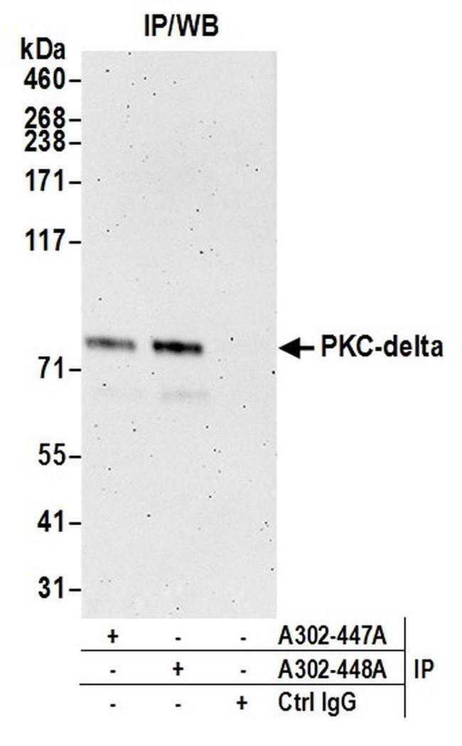PKC-delta Antibody in Western Blot (WB)