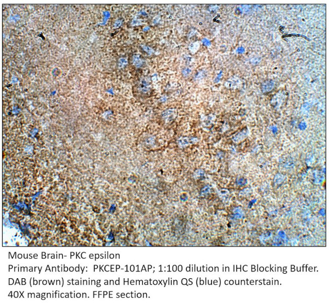 PKC epsilon Antibody in Immunohistochemistry (IHC)
