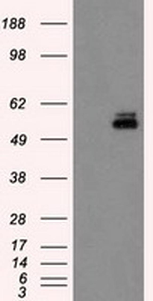 PKMYT1 Antibody in Western Blot (WB)