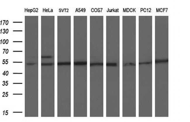 PKMYT1 Antibody in Western Blot (WB)