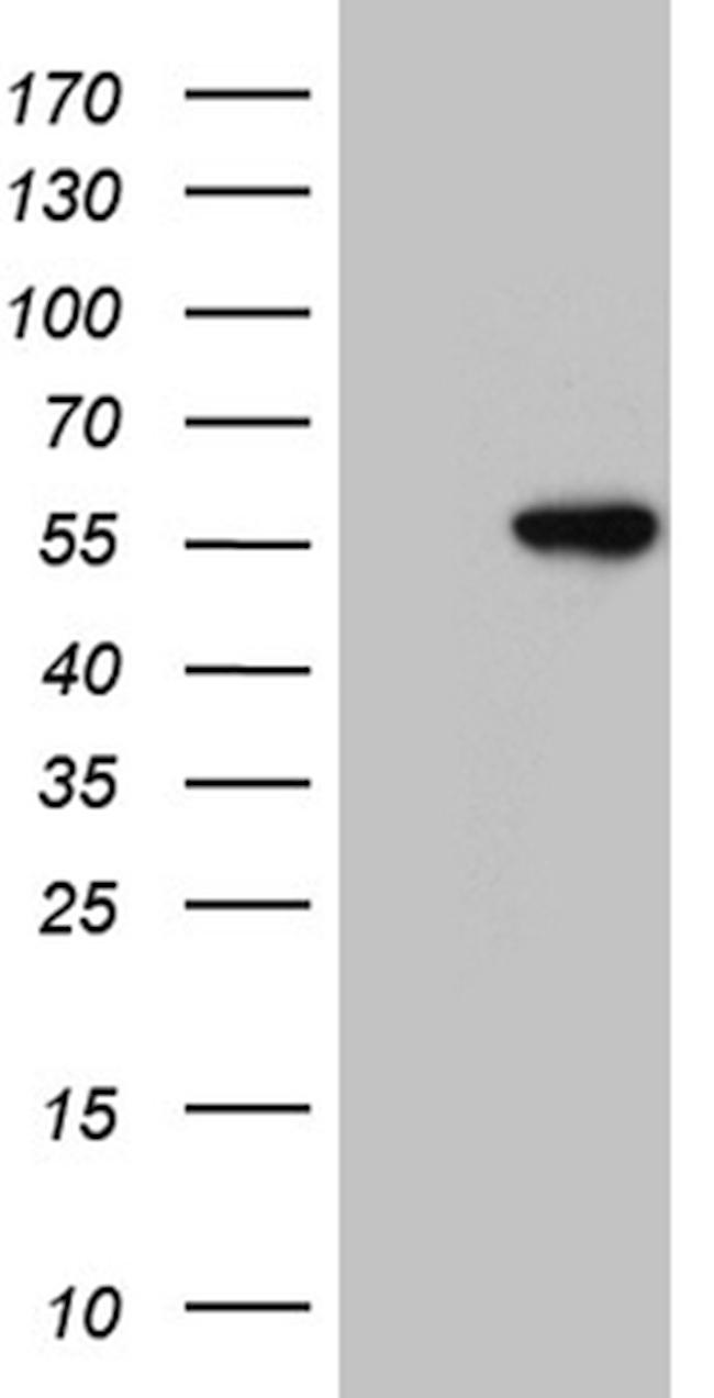 PLIN5 Antibody in Western Blot (WB)