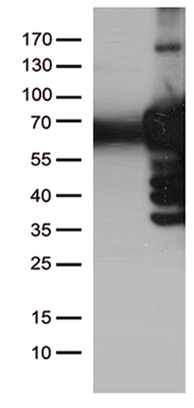 PLK1 Antibody in Western Blot (WB)