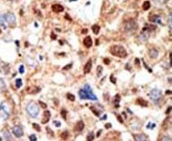 PML Antibody in Immunohistochemistry (Paraffin) (IHC (P))