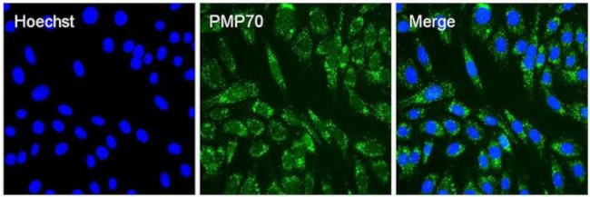 PMP70 Antibody in Immunocytochemistry (ICC/IF)
