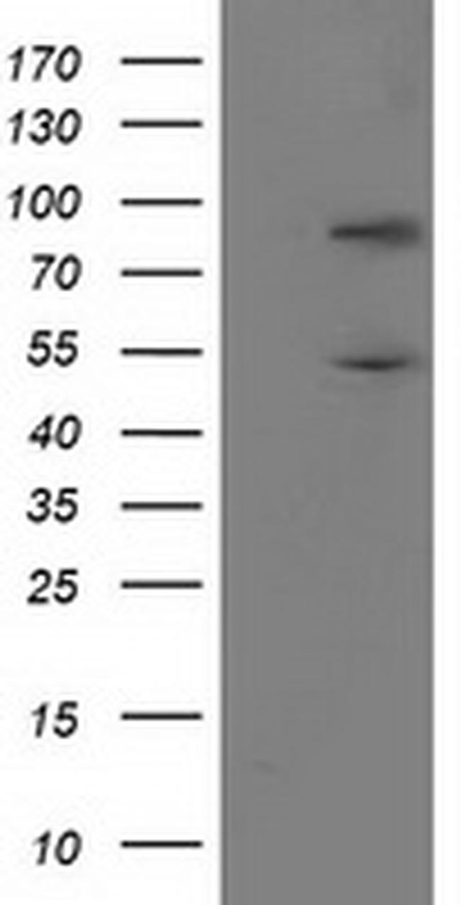 PNMA3 Antibody in Western Blot (WB)