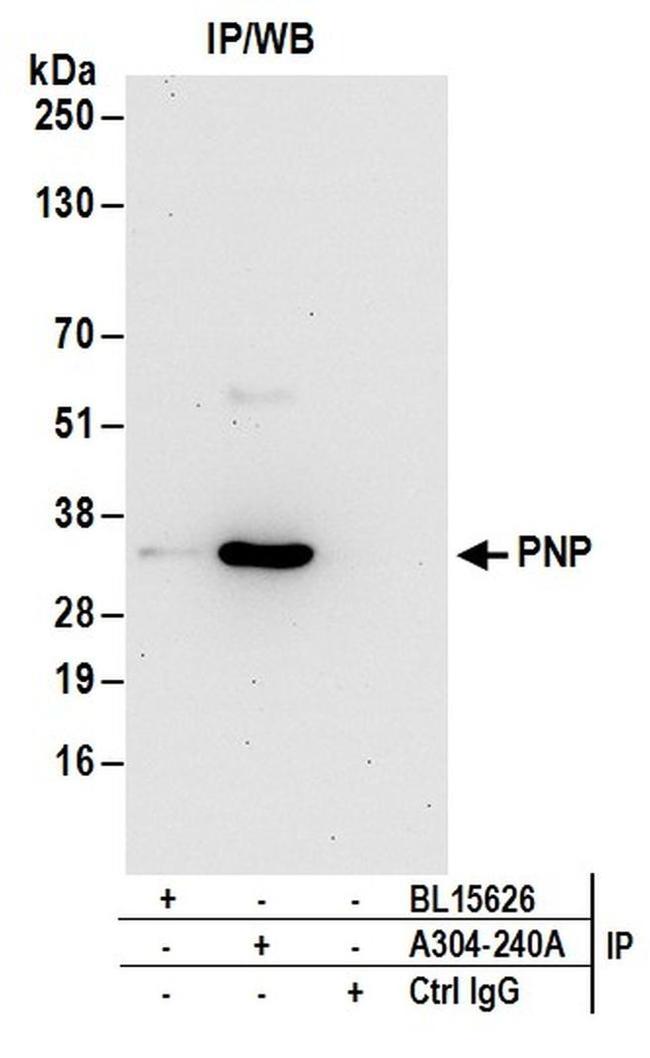 PNP Antibody in Western Blot (WB)