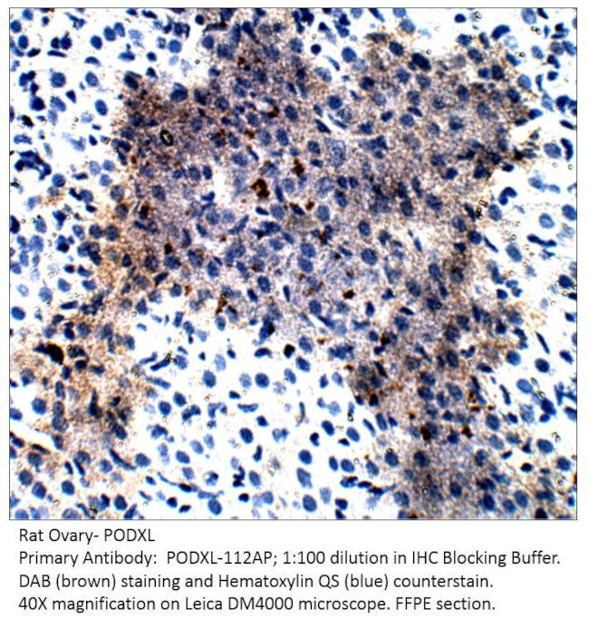 PODXL Antibody in Immunohistochemistry (IHC)