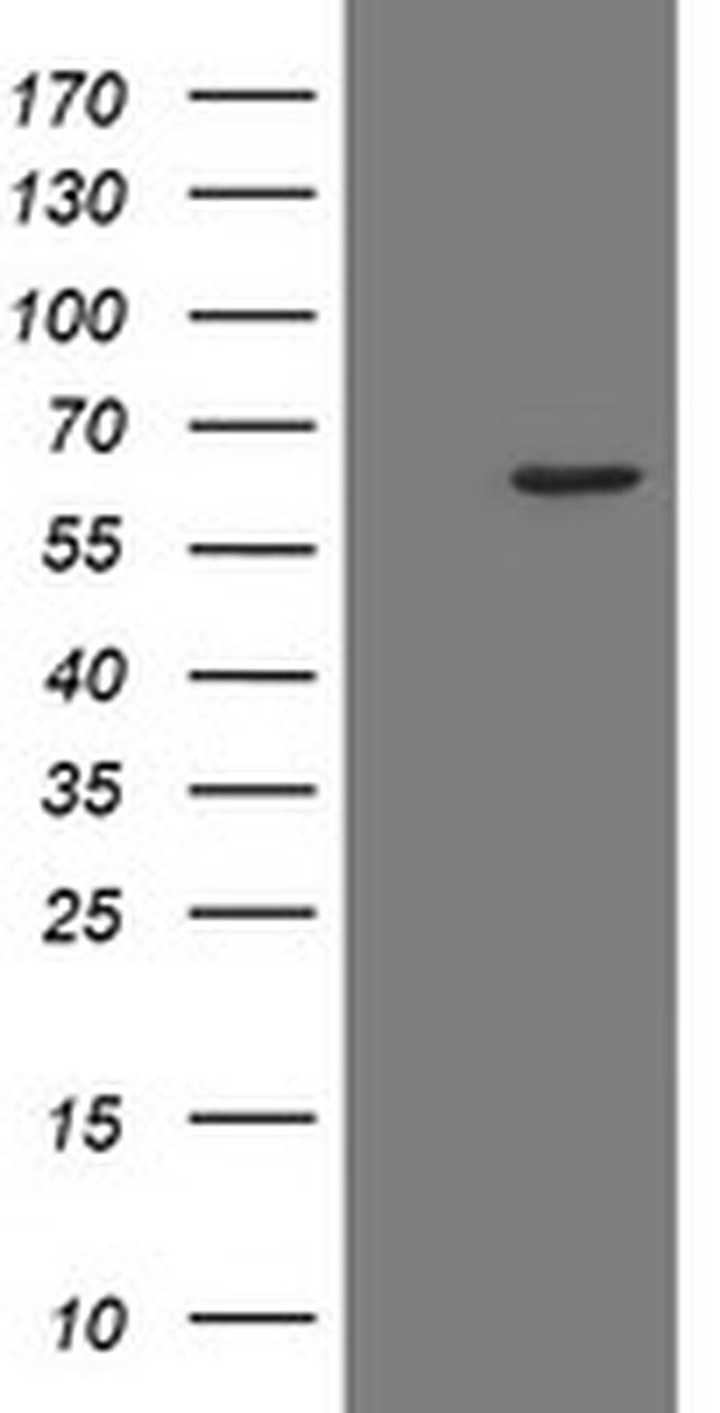 POLR3C Antibody in Western Blot (WB)