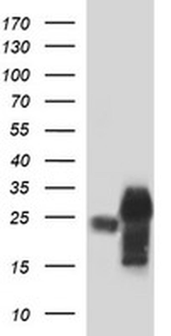 POMC Antibody in Western Blot (WB)