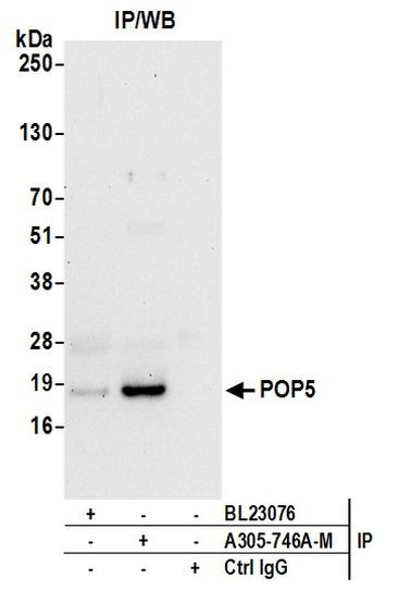 POP5 Antibody in Immunoprecipitation (IP)