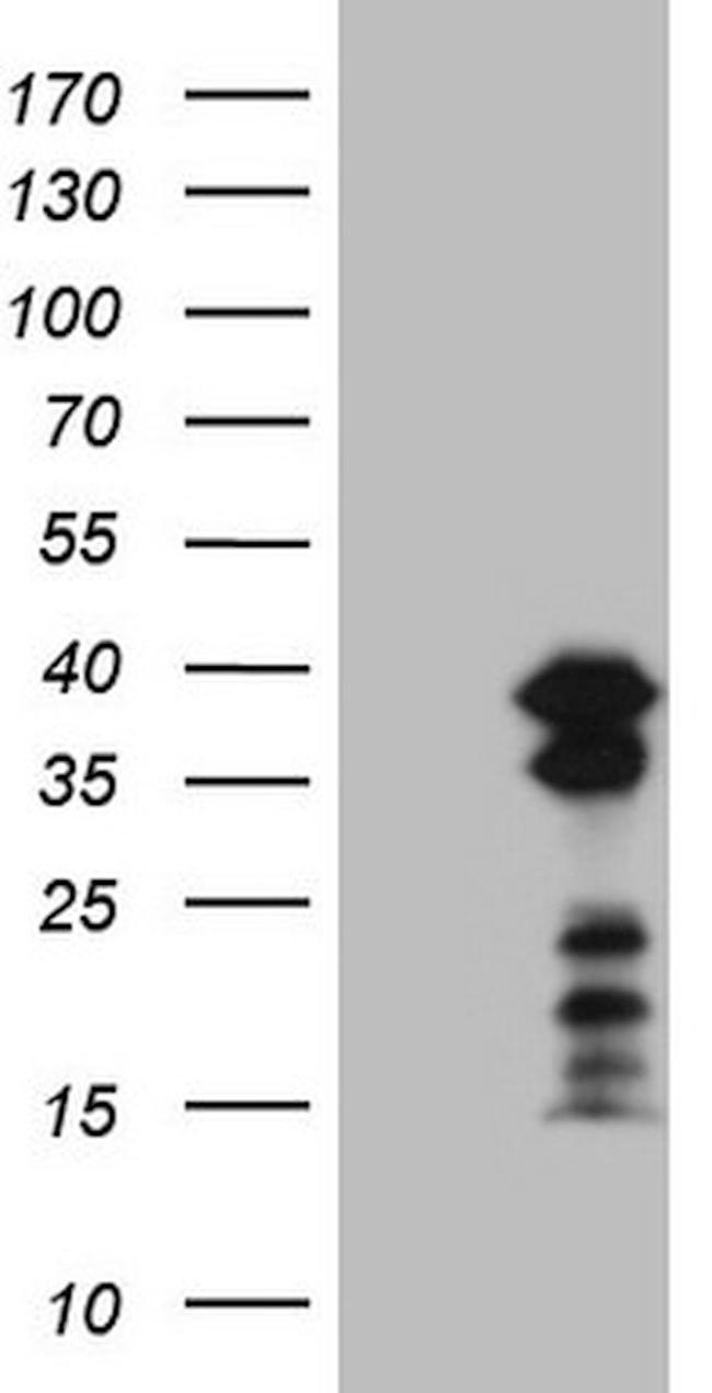 POU2AF1 Antibody in Western Blot (WB)