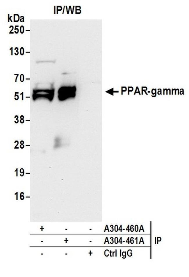 PPAR-gamma Antibody in Western Blot (WB)