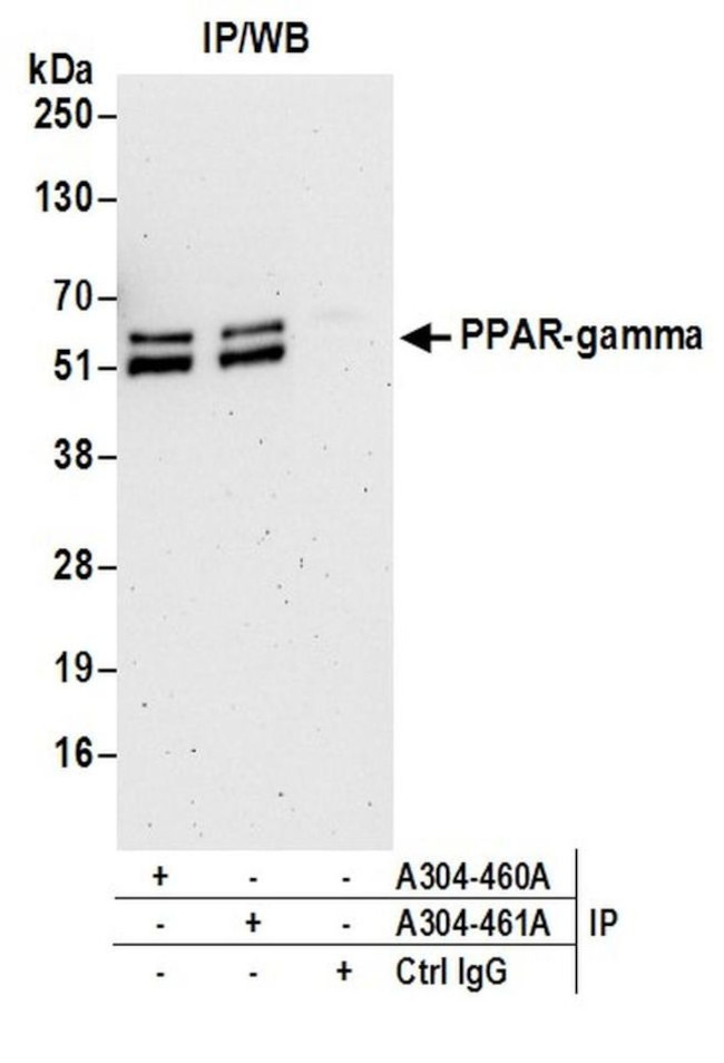PPAR-gamma Antibody in Immunoprecipitation (IP)