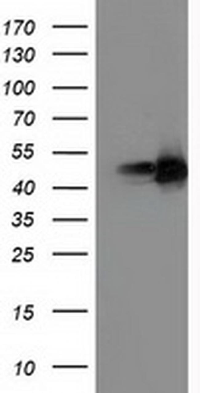 PPARA Antibody in Western Blot (WB)