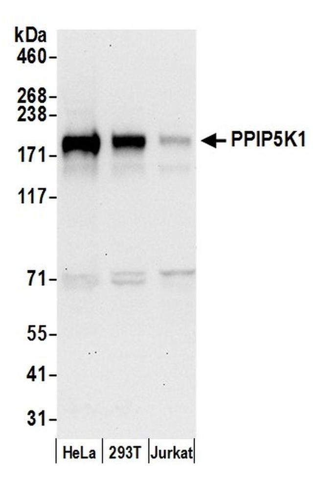 PPIP5K1/HISPPD2A Antibody in Western Blot (WB)