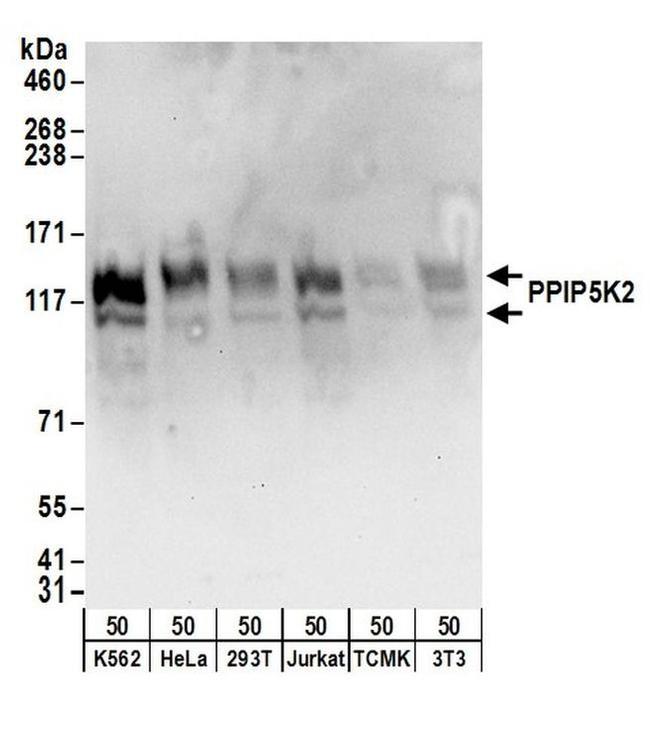 PPIP5K2 Antibody in Western Blot (WB)
