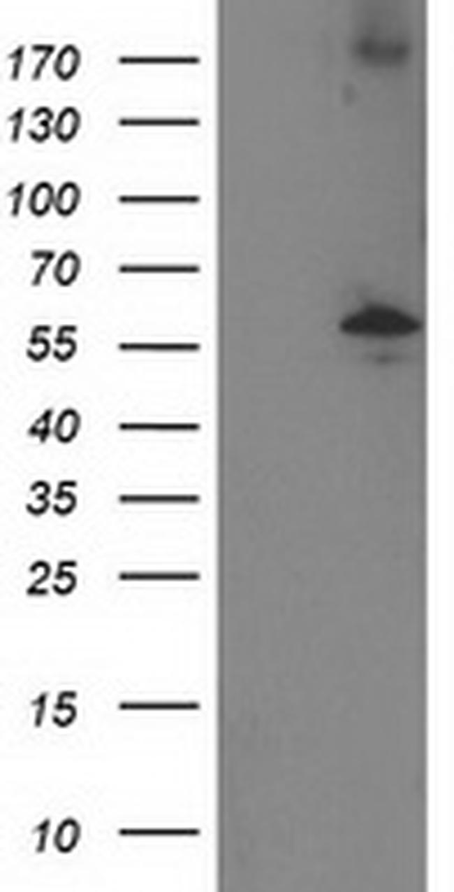 PPM1B Antibody in Western Blot (WB)