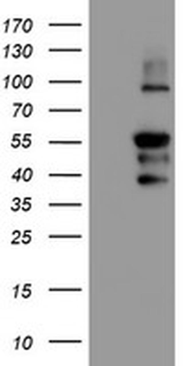 PPP1R15A Antibody in Western Blot (WB)