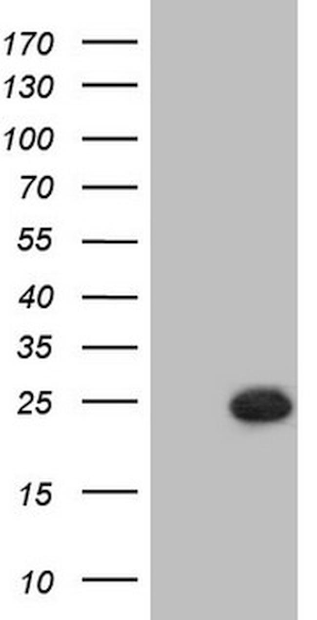 PPP1R17 Antibody in Western Blot (WB)