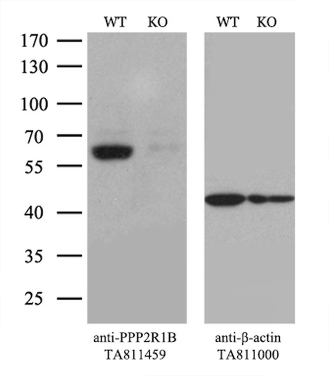 PPP2R1B Antibody