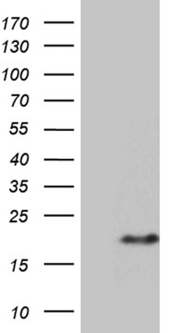 PRELID2 Antibody in Western Blot (WB)