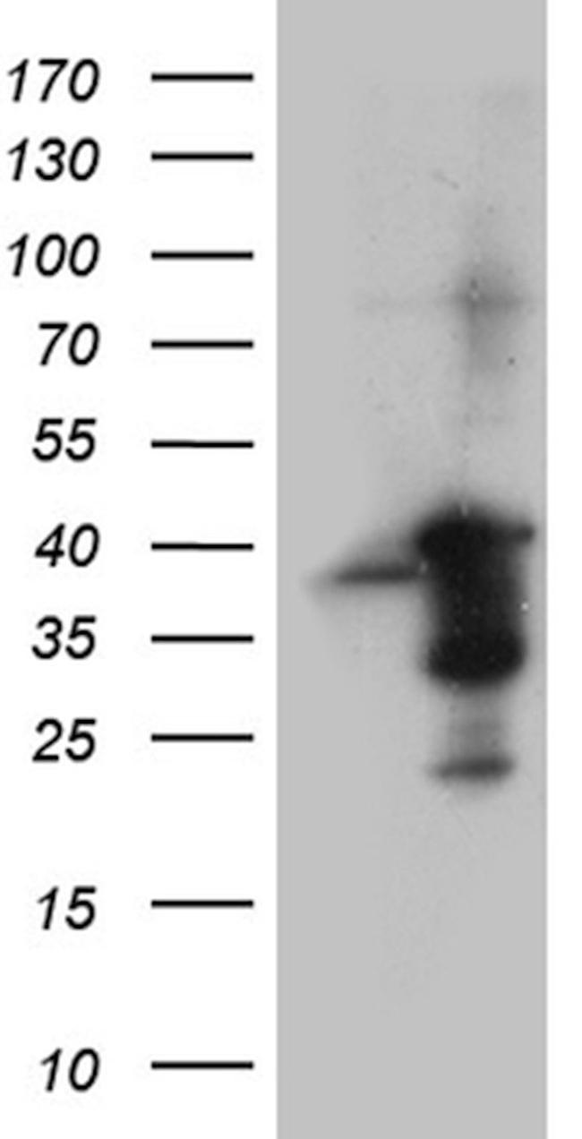 PRKAB1 Antibody in Western Blot (WB)
