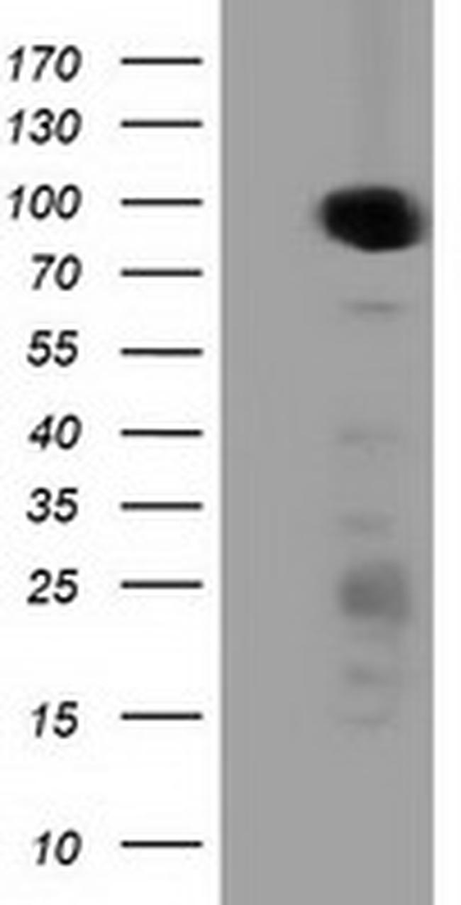 PRKD2 Antibody in Western Blot (WB)