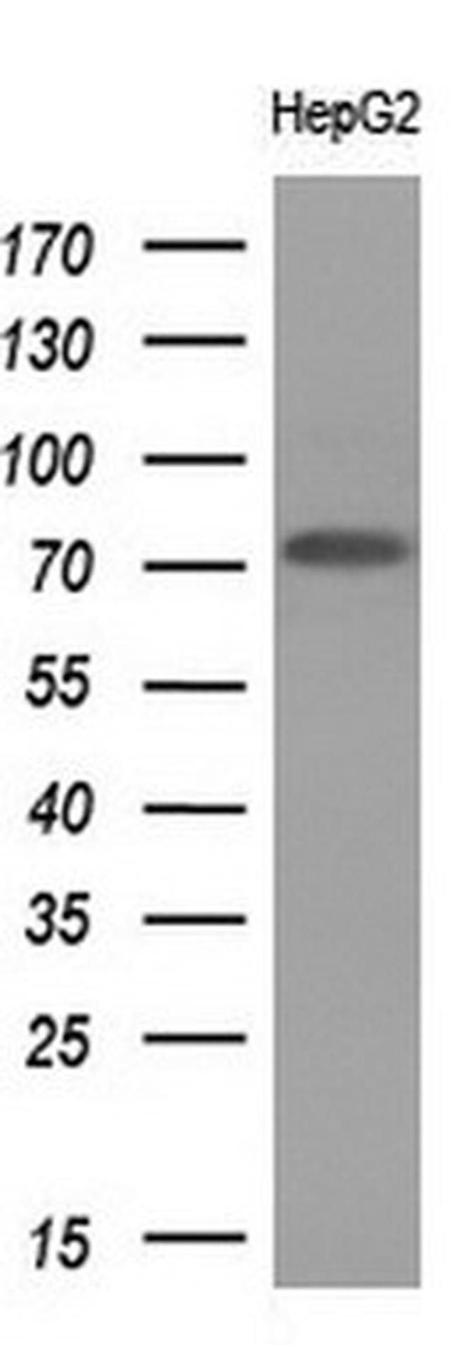 PRMT5 Antibody in Western Blot (WB)