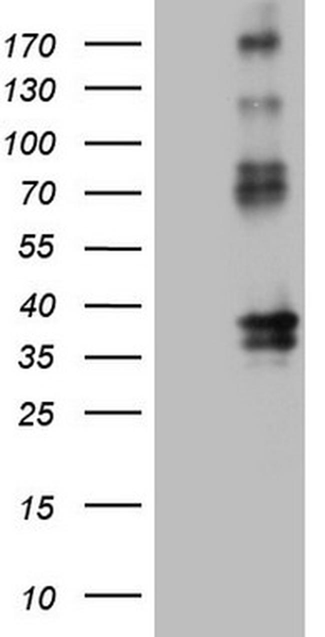 PROCR Antibody in Western Blot (WB)