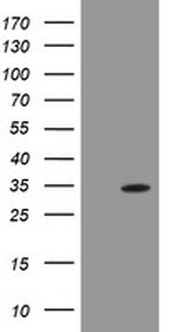 PROSC Antibody in Western Blot (WB)