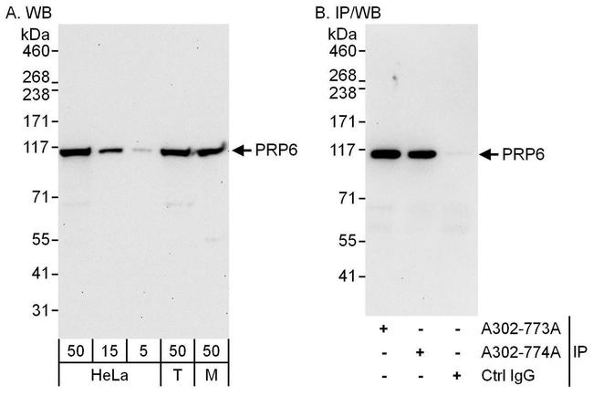 PRP6 Antibody in Western Blot (WB)