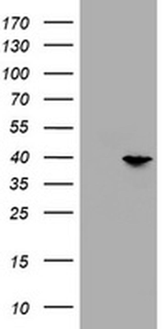 PRR11 Antibody in Western Blot (WB)