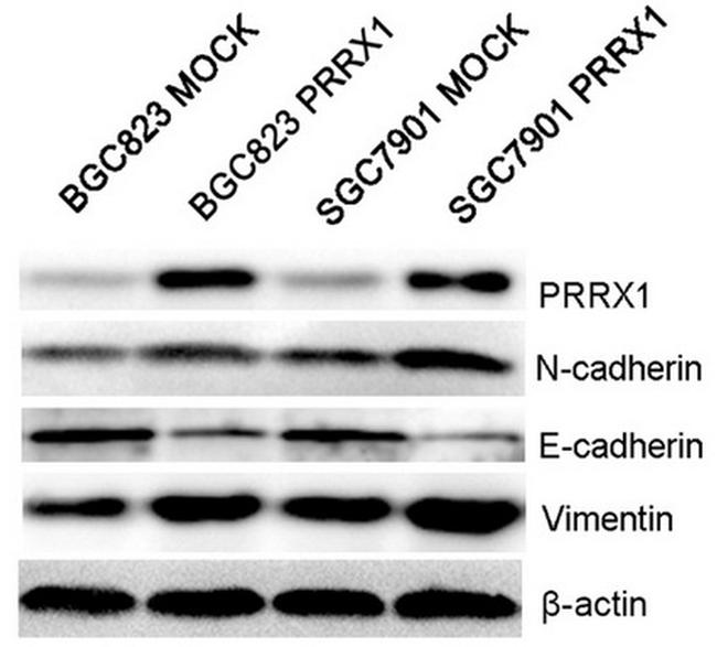 PRRX1 Antibody in Western Blot (WB)