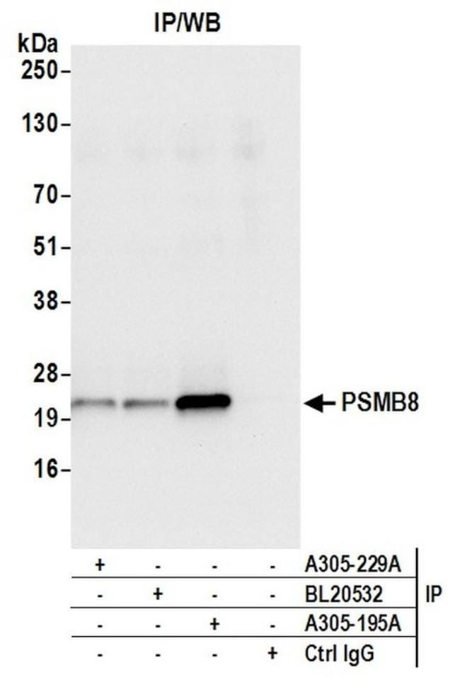PSMB8/LMP7 Antibody in Immunoprecipitation (IP)