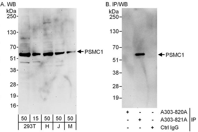PSMC1 Antibody in Western Blot (WB)