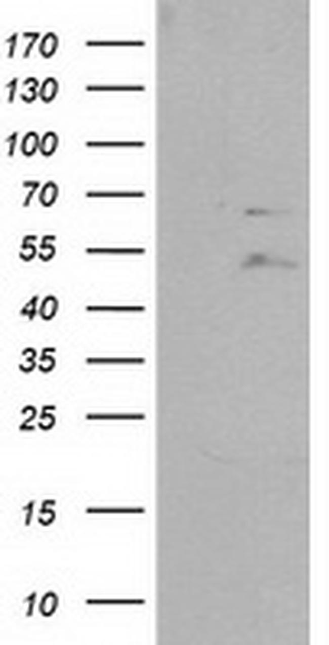 PTPN11 Antibody in Western Blot (WB)