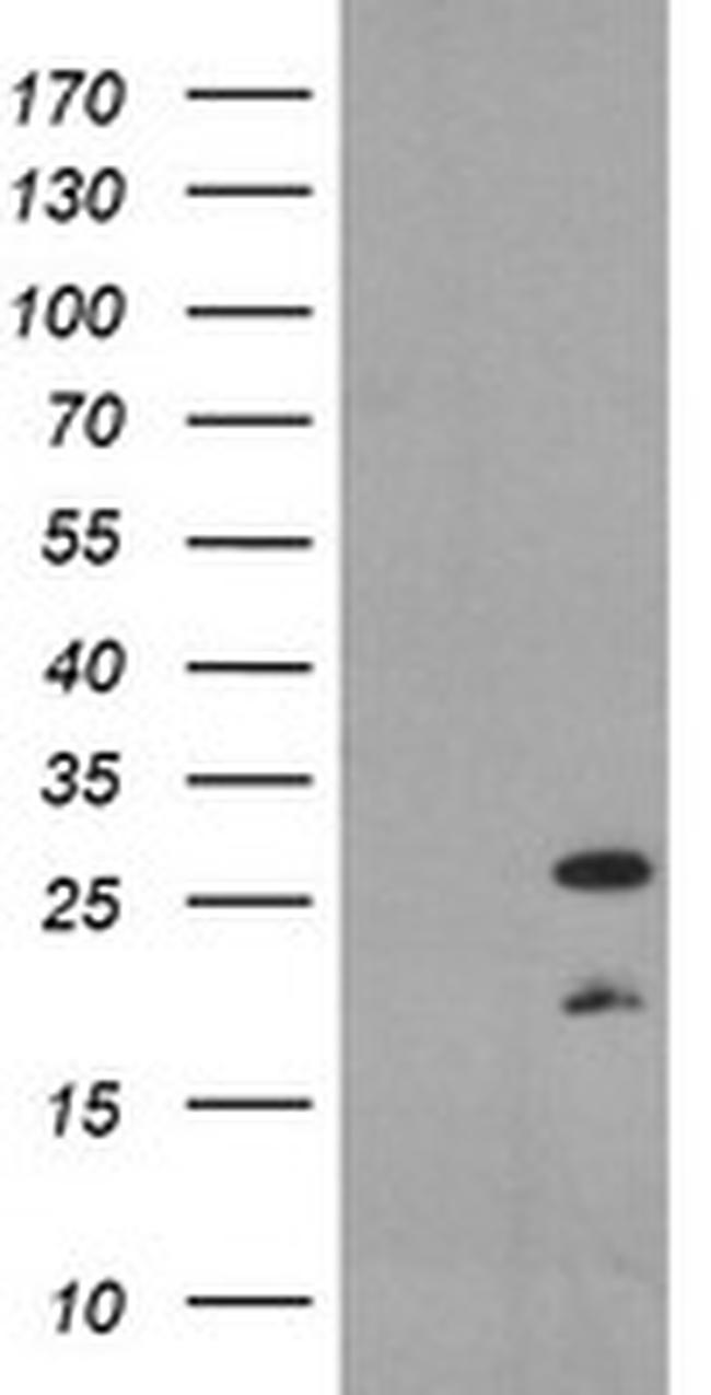 PYCARD Antibody in Western Blot (WB)