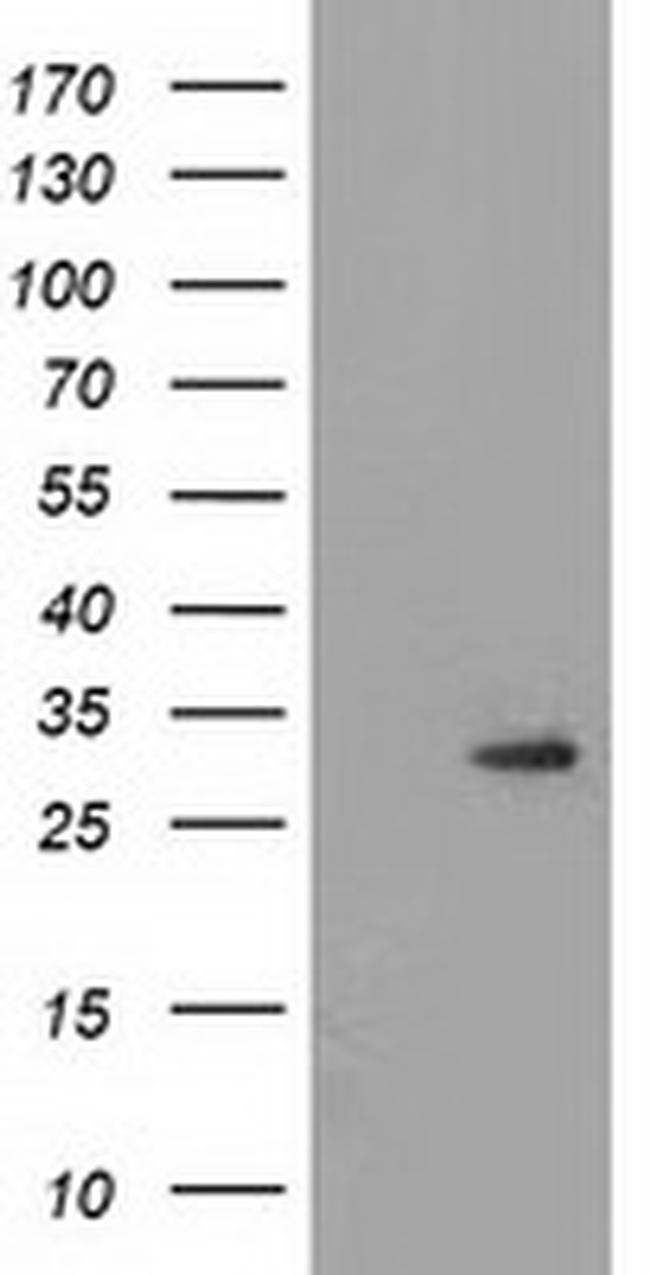PYCR2 Antibody in Western Blot (WB)