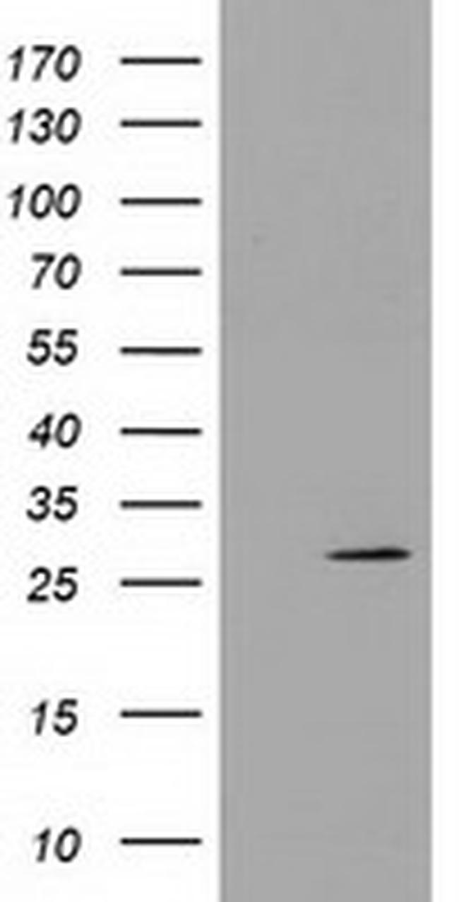 PYCRL Antibody in Western Blot (WB)