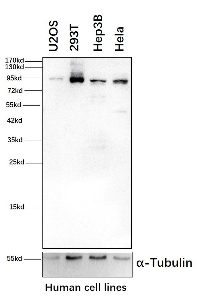 PYGL Antibody in Western Blot (WB)