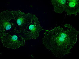 Patched1 Antibody in Immunocytochemistry (ICC/IF)