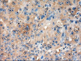 Patched1 Antibody in Immunohistochemistry (Paraffin) (IHC (P))