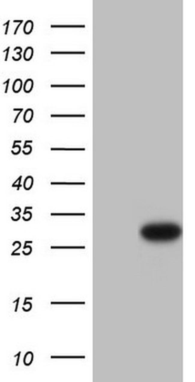 Patched1 Antibody in Western Blot (WB)