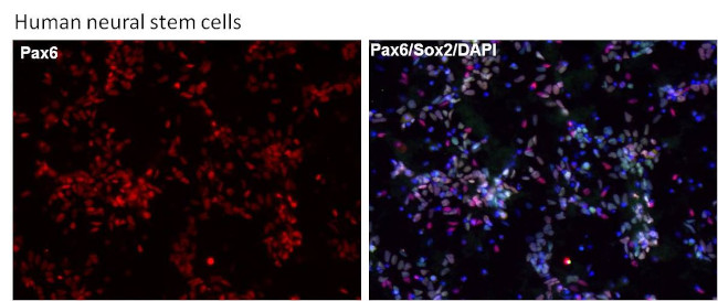 PAX6 Antibody in Immunocytochemistry (ICC/IF)