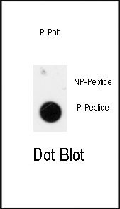 Phospho-TEM8 (Tyr425) Antibody in Dot Blot (DB)