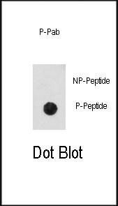 Phospho-CDK2 (Thr14) Antibody in Dot Blot (DB)