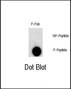 Phospho-FGFR1 (Tyr307) Antibody in Dot Blot (DB)
